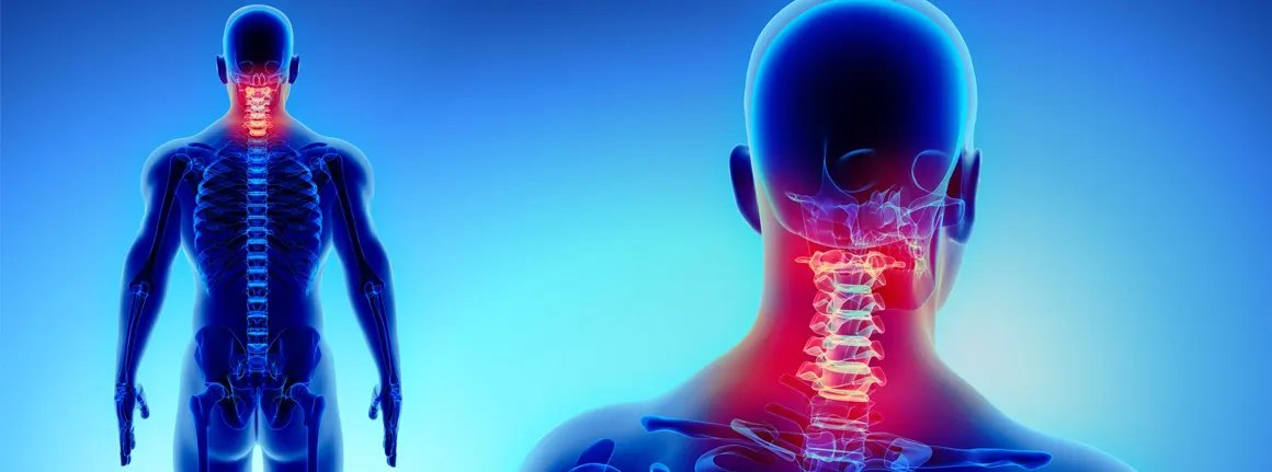 Neck pain and chiropractic