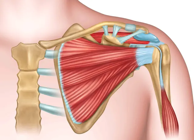 Shoulder - Rotator cuff tendonitis